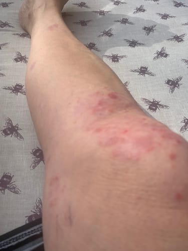 Customer photo review of Multi Strain Biotic