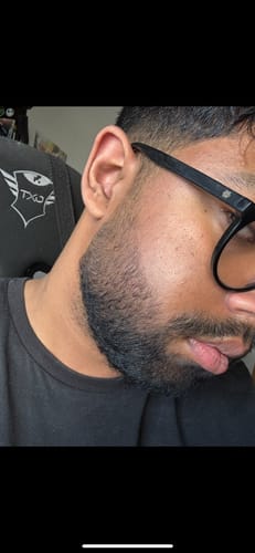 Customer photo review of Coffret Viking | Kit Professionnel Pousse Barbe