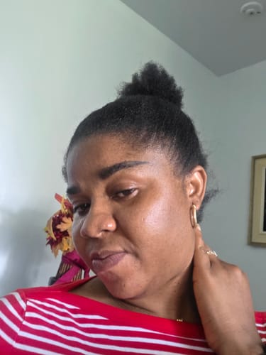 Customer photo review of Face Radiance Serum (Dark spot corrector)