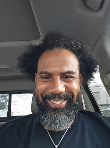 Customer photo review of Rennora Hair Growth Serum