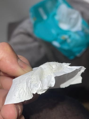 Customer photo review of Deep Cleansing Patch System