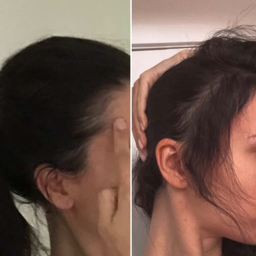 Customer photo review of Hair Growth Oil