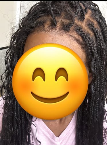 Customer photo review of The Complete All in One Wig Install Kit