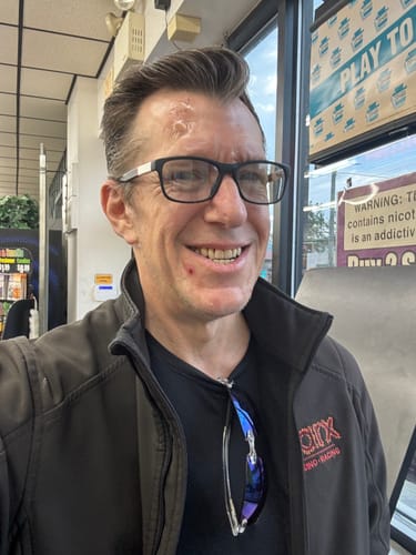 Customer photo review of Clear Skin Formula Acne Nutraceutical