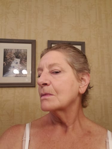 Customer photo review of Glov Micro Infusion System