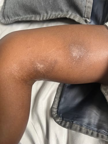 Customer photo review of Calm Balm