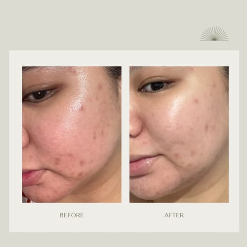 Customer photo review of Stay Fresh Moisturizer Controls Oil and Brightens