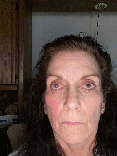 Customer photo review of Glov Micro Infusion System