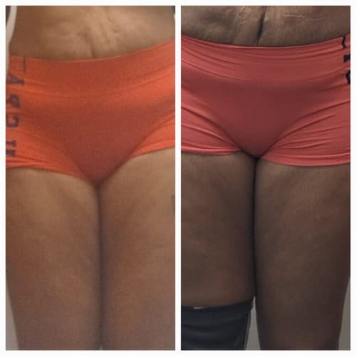 Customer photo review of "Waist NoMo" Slimming Cream