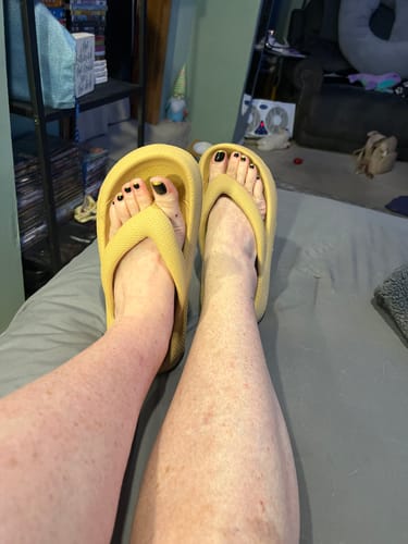 Customer photo review of Orthopedic Flip Flops - Cloud Slides