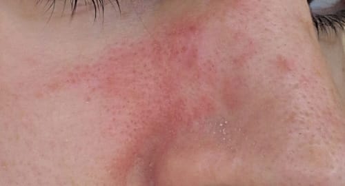Customer photo review of Seb Natural Calming Serum
