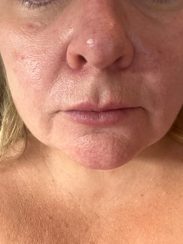Customer photo review of Seb Natural Calming Serum