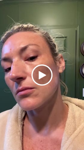 Customer video review of Glov Micro Infusion System