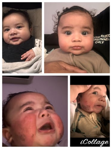 Customer photo review of Skin Rescue Set Hemp & Calendula