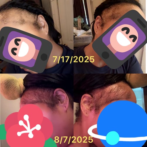 Renner W. review of ‼️25% off TODAY: CODE: BIGOIL25 ‼️ India’s Secret Ancient Ayurvedic Hair Follicle Elixir (5 sizes) image 1 out of 1