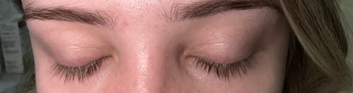 Customer photo review of Plume Elite Lash & Brow Enhancing Serum | Safe Alternative to Prostaglandin | Zero Side Effects