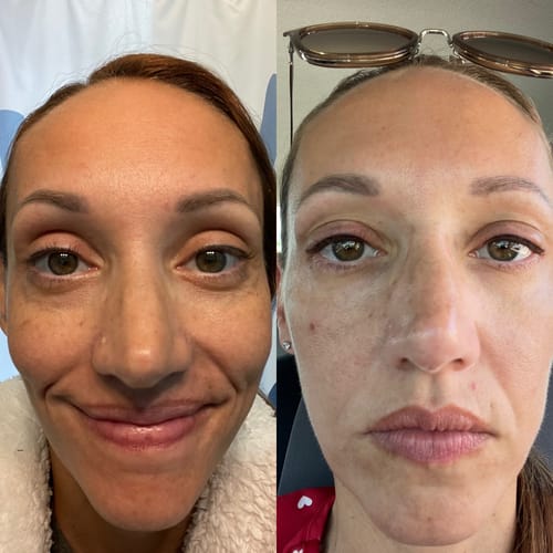 Customer photo review of 6-in-1 Daily Glow & Moisturize