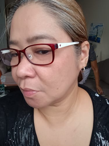 Customer photo review of Bad Skin™ Korean Collagen Bomb Hydrating Ampoule