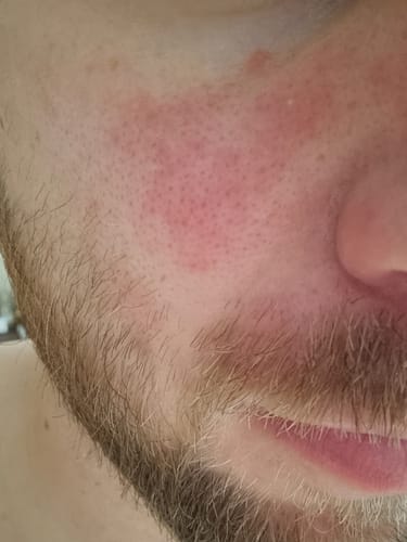 Customer photo review of Seb Natural Calming Serum