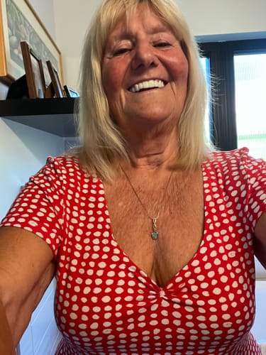 Customer photo review of Pop On Veneers with Impression Kit