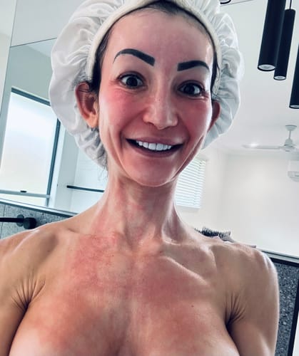 Customer photo review of *NEW* Dr. Pen M8S Microneedling Pen