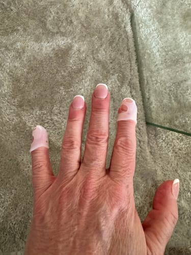 Customer photo review of Full Finger Protectors : Set of 5 – Super Stretchy Back in stock End of May