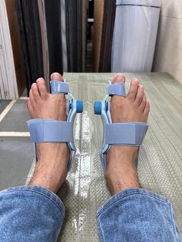Customer photo review of Frido Orthotics Bunion Corrector