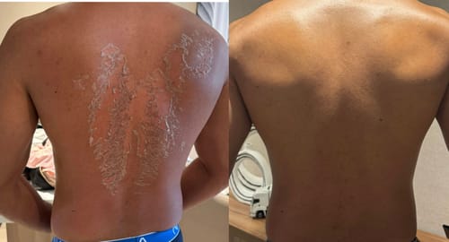 Customer photo review of Zena 100% Organic Algae Peel