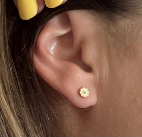 Customer photo review of Tiny Daisies