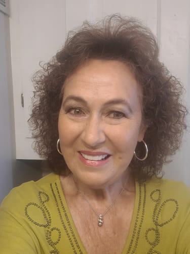 Customer photo review of Pop On Veneers with Impression Kit