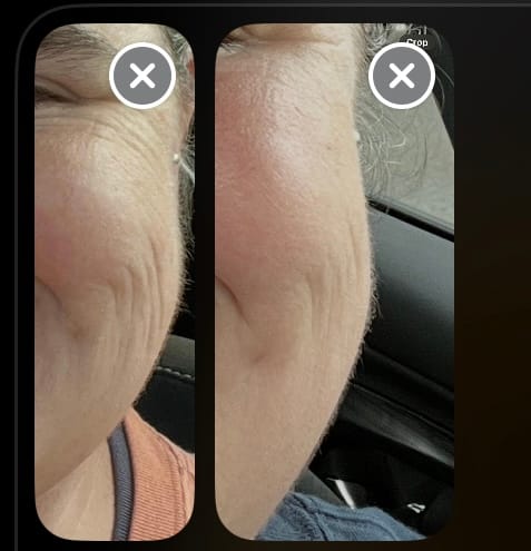 Customer photo review of Ageless Cloud Cream