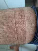 Customer photo review of Maintien de compression Été V2 pour Genoux et Jambes