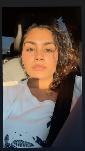 Customer photo review of Bee Balm Lip Masks - Special Offer