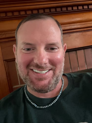 Customer photo review of Payment Plan - Pop On Veneers - With At Home Impression Kit