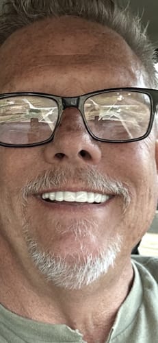 Customer photo review of Spare Veneers