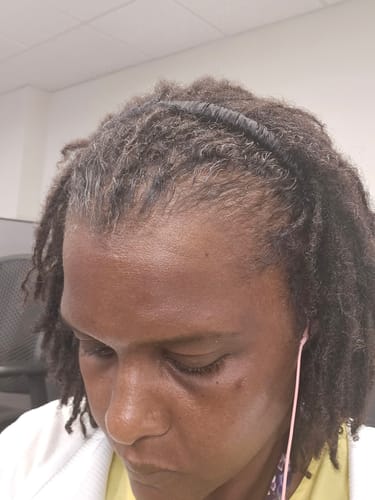 Customer photo review of Midnight Blooms Comfort Curve Silk Headband Set