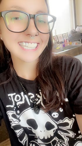 Customer photo review of Pop On Veneers with Impression Kit