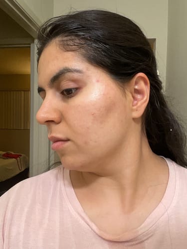 Customer photo review of See Spot Run Mini | Face Mask