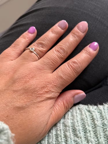 Customer photo review of Verzending Verzekering