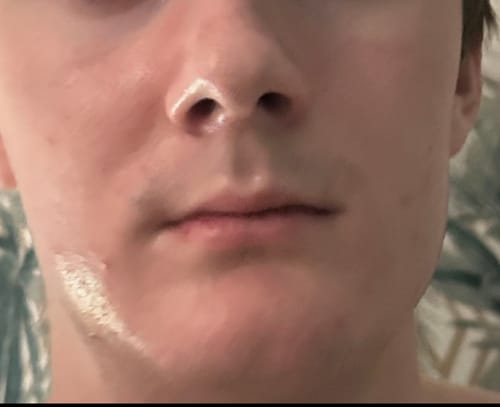 Customer photo review of Seb Natural Calming Serum