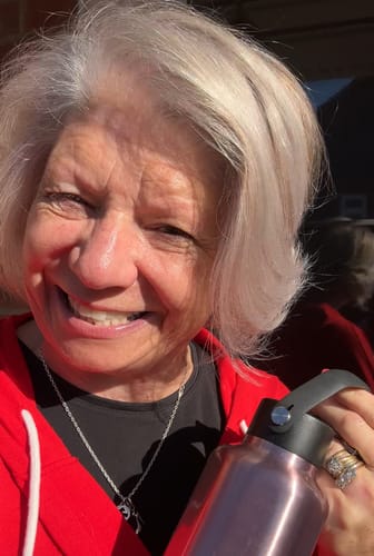 Customer photo review of 5-Step Clear Skin Kit