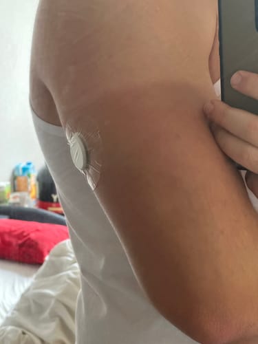 Customer photo review of Skin Grip Original - Freestyle Libre 2+ & Lingo Adhesive Patches