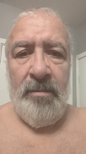Customer photo review of Seb Natural Calming Serum