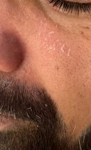 Customer photo review of Seb Natural Calming Serum
