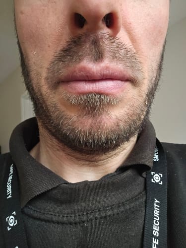 Customer photo review of Seb Natural Calming Serum
