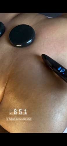Customer photo review of Achedaway Mini Scraper:On-the-Go heated muscle scraping tool