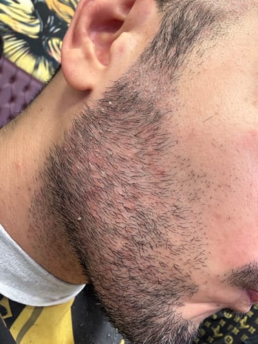 Customer photo review of Seb Natural Calming Serum