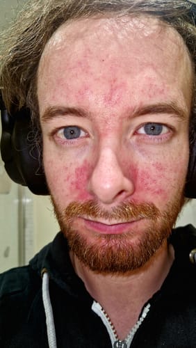 Customer photo review of Seb Natural Calming Serum