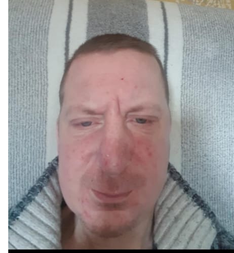 Customer photo review of Seb Natural Calming Serum