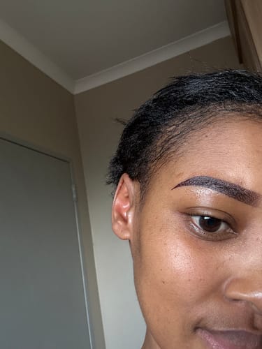 Customer photo review of Hairline Fortifying Serum 30ml - Minoxidil